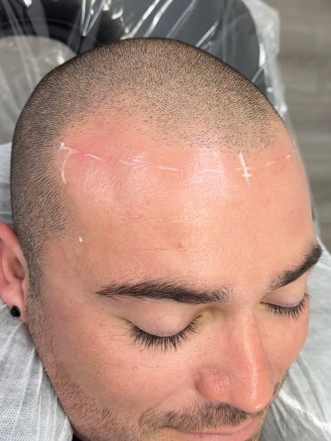 To Book Text: 559-792-5743📲

Follow For More Content🙌🏼
#smp #scalpmicropigmentation #hairloss #fi