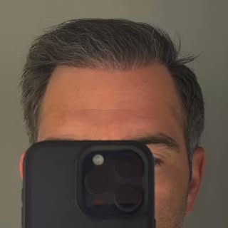 A five star Google Review of Dr. Panine and Chicago Hair Transplant Clinic.
07-31-2025
“Pictures are