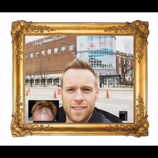 Dr. PANINE & Chicago Hair Transplant Clinic are internationally recognized leaders in hair restorati
