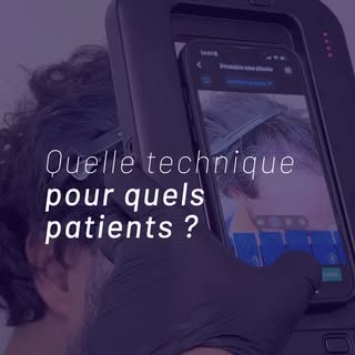 Deux techniques, une seule priorité : le bon choix pour votre implantation.

Le Choï permet une impl
