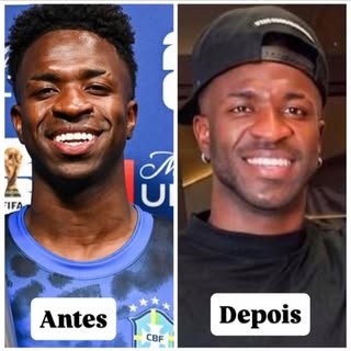 A internet adora comparar um antes e depois e cravar procedimento. Mas antes de tirar conclusões, le