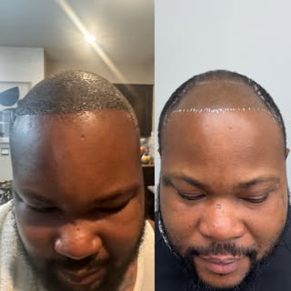 REAL RESULTS. REAL CONFIDENCE. 🔥

This is what happens when precision meets experience.
No filters.