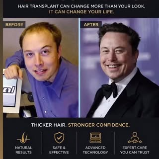 🔥 MAY TRANSFORMATION SPECIAL 🔥

This isn’t just hair… it’s your confidence making a comeback.

✨ $