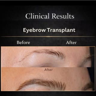✨ Natural brows. Real confidence. ✨

A subtle change can make a huge difference. 👌

Check out this 