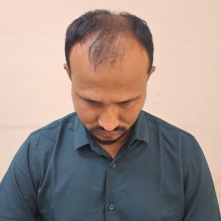 🔥 কুয়েত প্রবাসী মাসুদ রানা ভাইয়ের নতুন চুলের যাত্রা শুরু! 🇰🇼➡️🇧🇩

আলহামদুলিল্লাহ ❤️
আজ কুয়েত প্