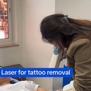 Tattoo Removal