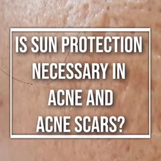 Sunprotection for acne and acne scars.