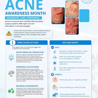 June is Acne Awareness Month! 💙 Acne ranks as the 8th most common disease worldwide, affecting 85% 