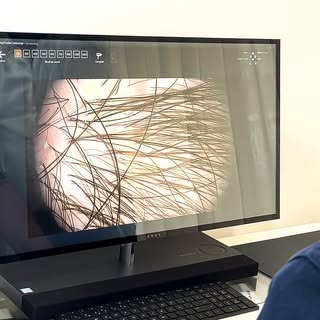 Diagnóstico capilar con tecnología de precisión.

En Clínica de Freitas y Clínica Holsttein, utiliza