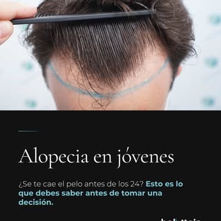 La alopecia no avisa. Y cuando aparece a temprana edad, la primera reacción suele ser buscar una sol
