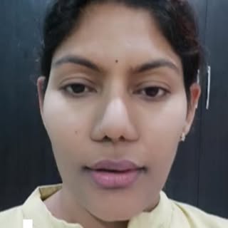 Steroid Acne is very common problem faced by many people nowadays specially post COVID recovery, it 