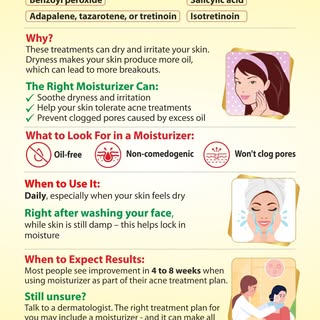 Moisturizer & Acne : Why you Still Need It.
