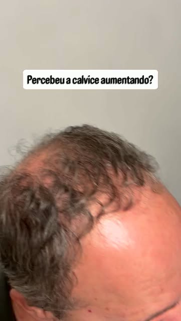 Você já notou alguma mudança no seu cabelo ultimamente? Comente aqui ou agende sua a Consulta (37) 9