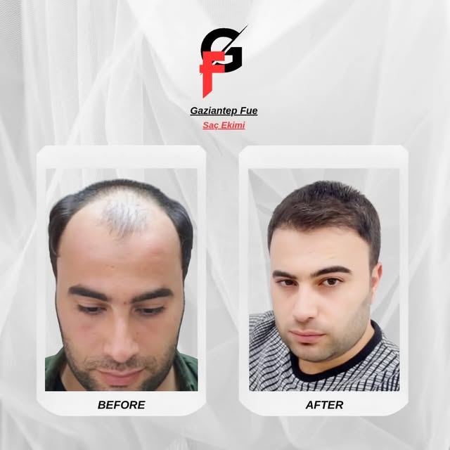 Aynalarla barışma zamanı geldi! ✨ Değişimin sadece dış görünüşte değil, ruhunuzda yarattığı etkiyi h
