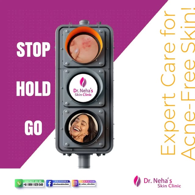 Stop🛑Hold🟡Go🟢
Expert Care for Acne-Free Skin!!
@dr_nehas_skinclinic