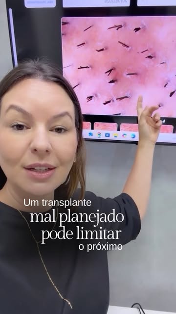 Nem sempre é possível simplesmente fazer outro transplante para corrigir um resultado ruim.

Esse pa