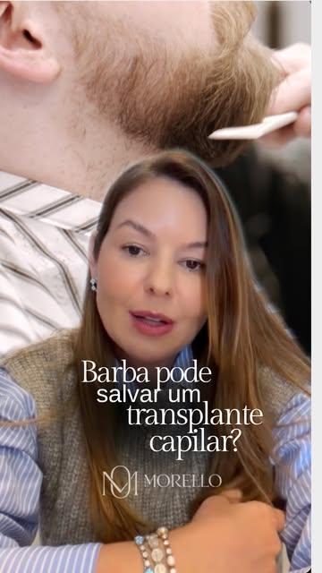 Quando a área doadora do couro cabeludo não oferece fios suficientes, podemos recorrer aos fios de o