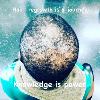 #haircarespecialist 
#hairlossspecialist 
#hairtreatment 
#protectivehairstyles
