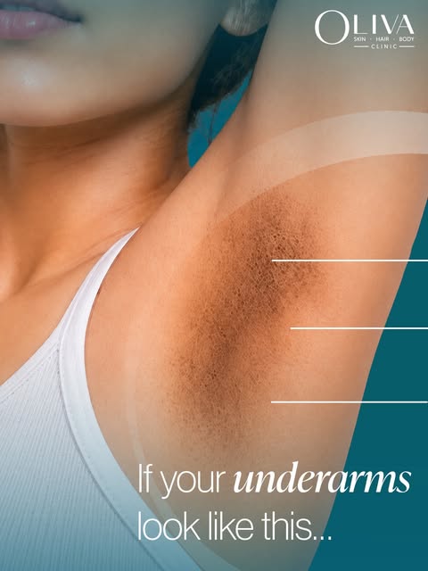 Afraid to lift your arms up because of dark underarms?

dermOLIV’s Under Arm & Neck Cream is clinica