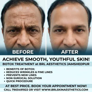 ✨ Rejuvenate Your Skin with Botox Treatment ✨

Look fresher, younger & more confident with advanced 
