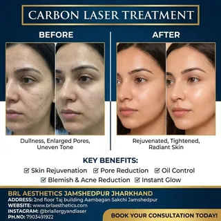 ✨ Say Goodbye to Oily, Dull Skin! ✨

Get an instant glow with Carbon Laser Treatment at BRL Allergy 