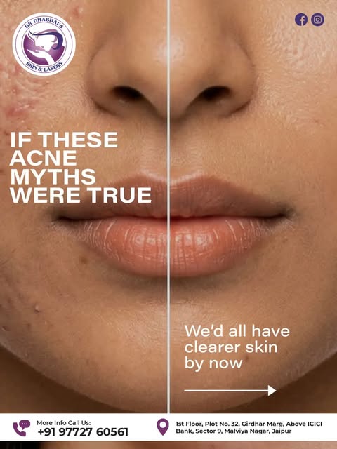 Acne myths vs. facts! 🧴✨
Not everything you hear about acne is true. From over-cleansing to skippin