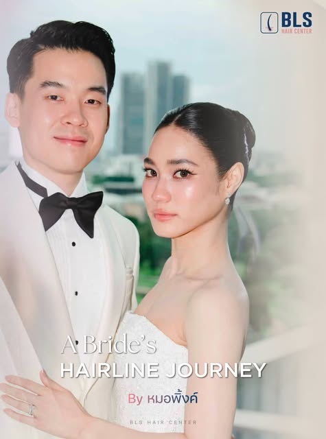 From BLS Hairline to the Bridal Look of Her Dreams. 👰🏻‍♀️✨

ด้วยเทคนิค Non-Shaven FUE
ปลูกผมโดยไม่