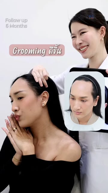 จบปัญหาหน้าผากสูง ปลูกผมกับ #หมอพิ้งค์BLS ผลลัพธ์ 6 เดือน ประทับใจสุด ๆ
Grooming ดูดี มั่นใจมากขึ้น
