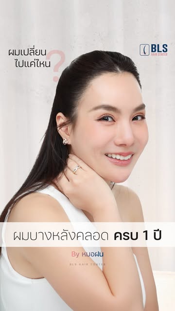 ปลูกผมคุณแม่หลังคลอด ผลลัพธ์ 1 ปี 
#หมอฝนBLS ออกแบบ BLS Hairline สวยแบบเป็นธรรมชาติ ปรับกรอบหน้าละมุ