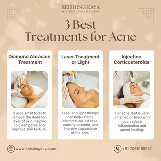 "No More Acne Worries!🙎‍♀️

Tired of acne ruining your confidence?

At Keishing Kaya, we offer adva