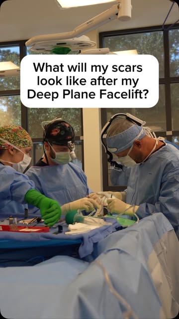 Worried about scarring after your deep plane facelift? @drtimminton’s got you covered! 😉✨

📍Savann