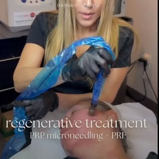 ✨ Natural Rejuvenation with Microneedling, PRP & PRF ✨

Are you a person age 20 to 75 looking for a 