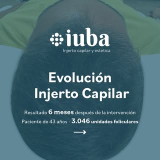 ✨ Hoy os presentamos el caso de Alejandro, 43 años.

Hace solo 6 meses decidió dar el paso y confiar