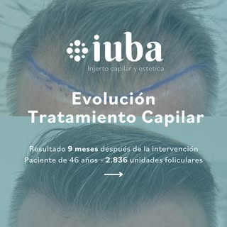 🔹José, 46 años🔹

✨🔎 Tras 9 meses de su cirugía, la evolución es muy favorable. Teniendo en cuenta