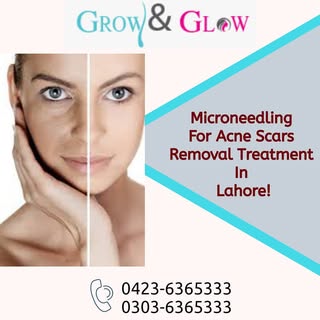 FUE Hair transplant, the most advanced and efficient surgical treatment for hair restoration. Get th