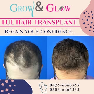 Rgain your confidence by choosing the best FUE hair transplant treatment for your loss hair...
for a