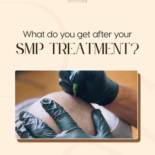 What SMP really gives is the reassurance that hair loss doesn’t have to define you and restores your
