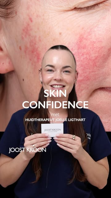 HET PERFECTE RESULTAAT
door huidtherapeut Joëlle Ligthart

Deze cliënt had na slechte ervaringen bij