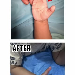 Syndactyly

For more details contact:
 Cuddalore-9940039202
  Pondicherry-7845839202
  Emergency-901