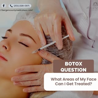 You can get Botox treatments in many different places on your face. These include the lines on your 