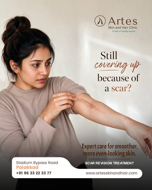 Your scar doesn’t have to stay forever.
SCAR REVISION TREATMENT 

📍 Artes Skin & Hair Clinic
Stadiu