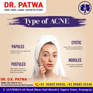 🤟🏻👍🏻Dr D.K. Patwa
"TYPES OF ACNES🌸🌿
Pustules: Pustules are similar to papules but contain pus 