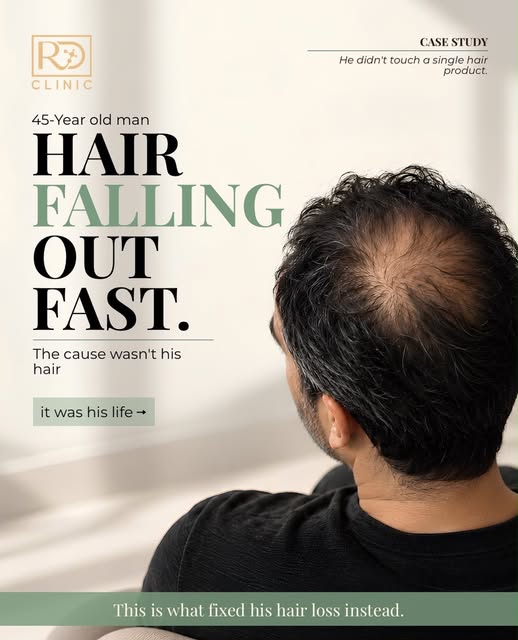 Plot twist: your hair fall might not be a hair problem at all. 👀🚨 

The real culprit could be hidi