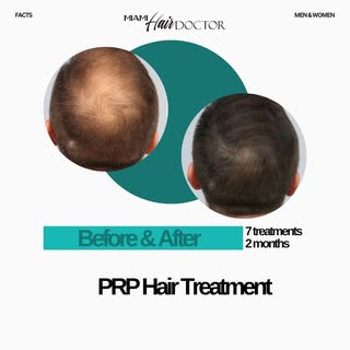 Real people, real results! 🤩 Check out this incredible before-and-after transformation! After just 