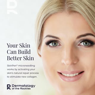 Your skin has the power to rebuild from within.

SkinPen® microneedling creates controlled microchan