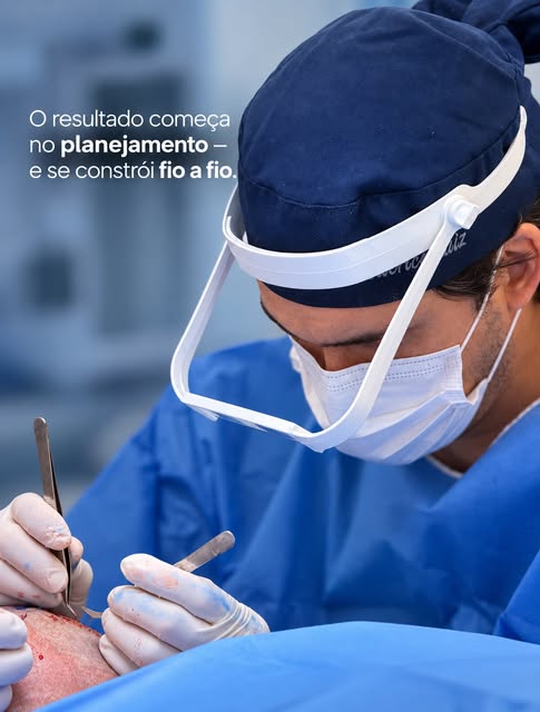 O resultado de um transplante capilar começa muito antes do primeiro fio ser implantado.

Cada proce