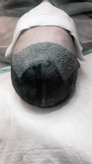 A sua testa incomoda quando você se olha no espelho ou prende o cabelo?

Essa é uma queixa mais comu