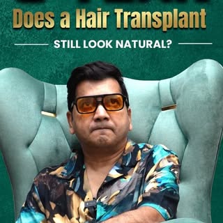 3 YEARS LATER: Does a Hair Transplant still look natural after three years? 👀 🤔

Absolutely! @saan