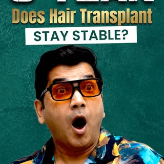 3 Years Later: Do Hair Transplant Results Stay Stable?

Yes — they absolutely can. And Saanand Verma