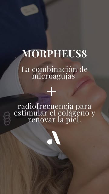 Morpheus8 combina microneedling y radiofrecuencia para estimular la producción de colágeno y elastin